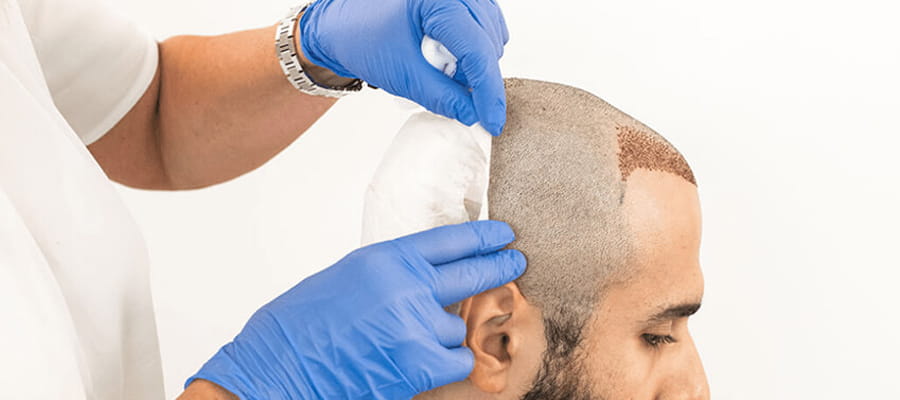 Hair Transplant  Hospital in Jaipur