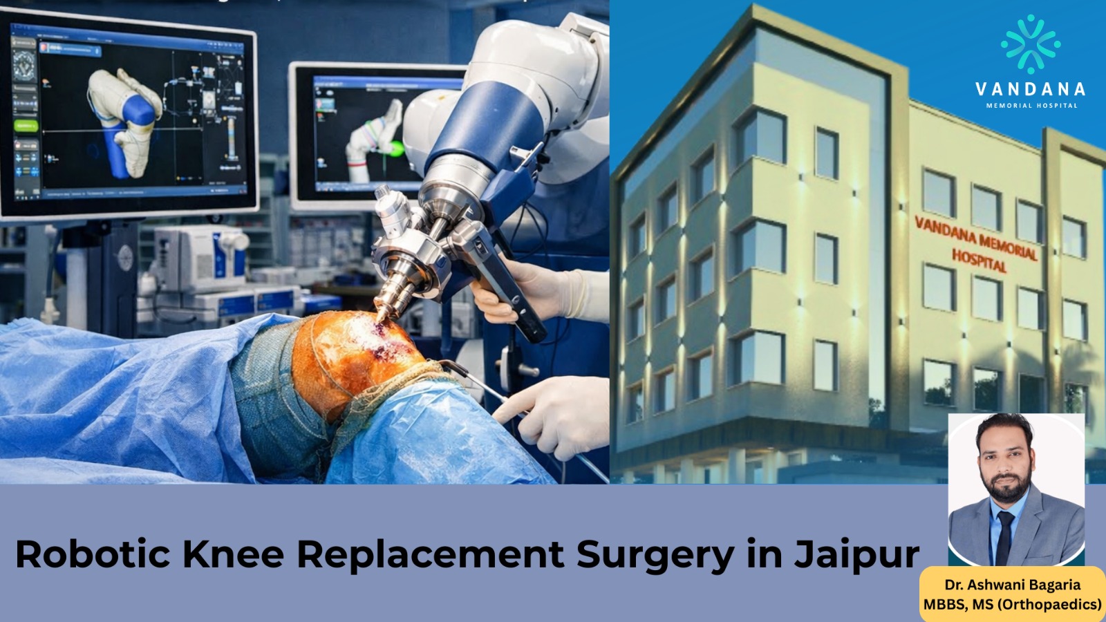 Image of Robotic-Knee-Replacement-Surgery-in-Jaipur