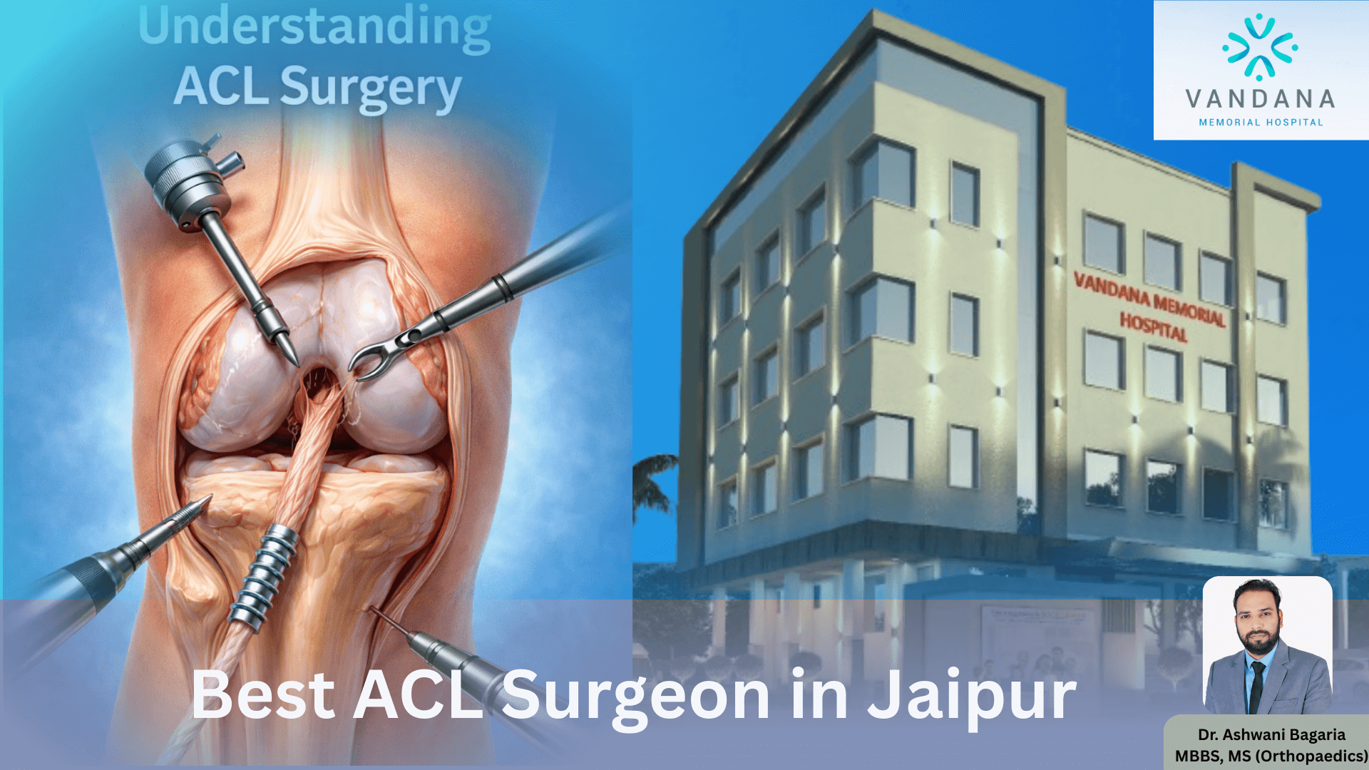 best-acl-surgery-in-jaipur