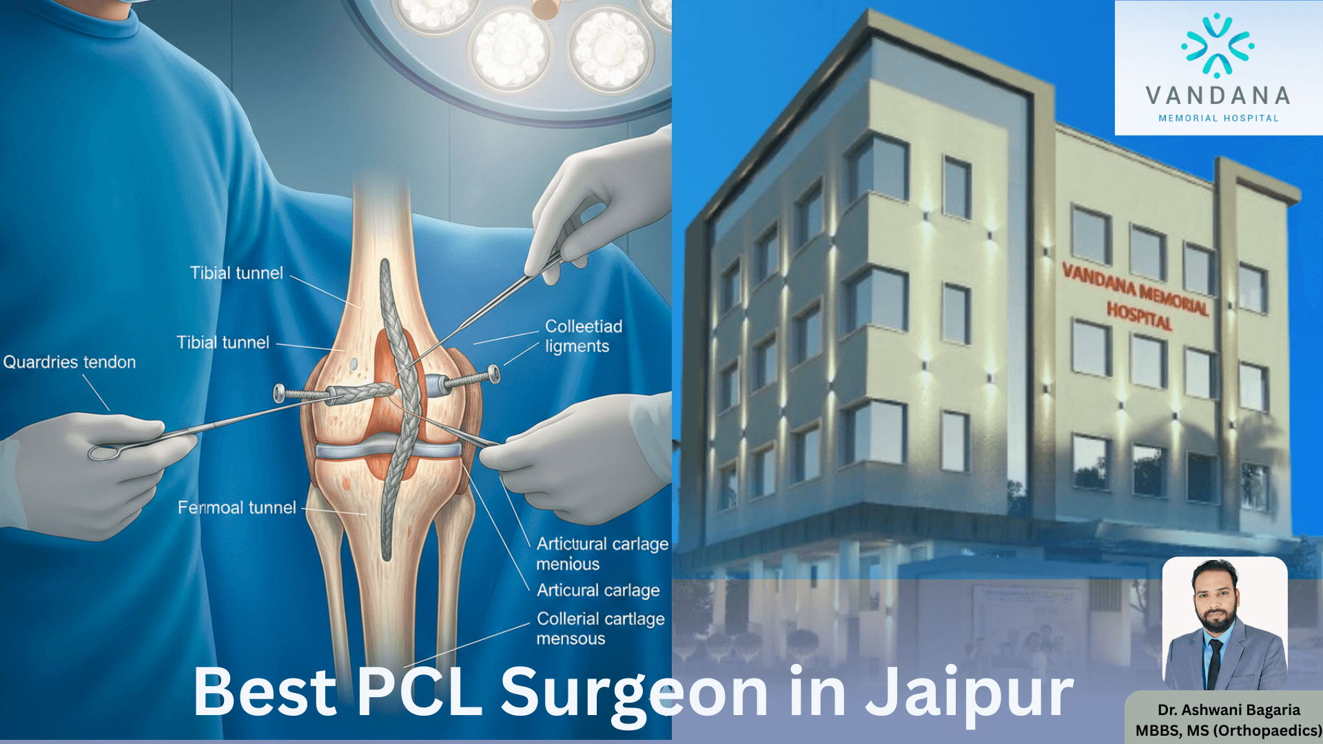best-pcl-surgery-in-jaipur