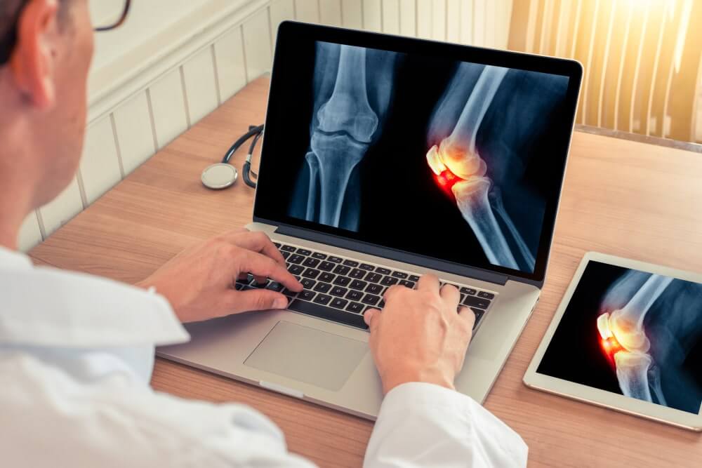 image of digital x ray