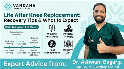 Life After Knee Replacement: Recovery Tips & What to Expect